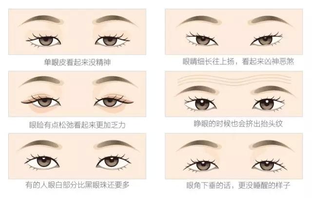 整形小知識(shí)多圖告訴你：雙眼皮怎么割