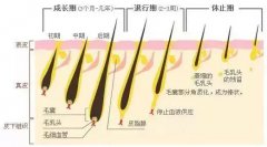 脫毛全攻略 分享一些脫毛小知識(shí)啦
