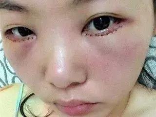 全球熱銷1000萬支！只要120秒去眼袋！從史泰龍老婆火到中國的！