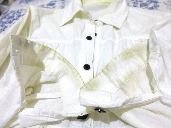 白衣服被染色發(fā)黃怎么辦？一招讓你的衣服立刻潔凈如新 必備！