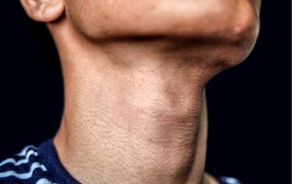 喉結(jié)不明顯的男人命苦嗎，男人的喉結(jié)明顯好不好
