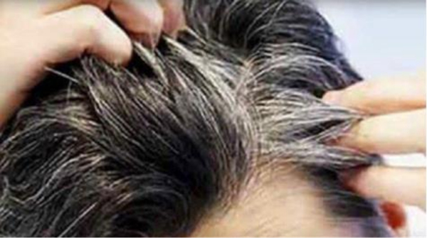 女人前額白發(fā)多是缺啥，女人前額白發(fā)吃什么好