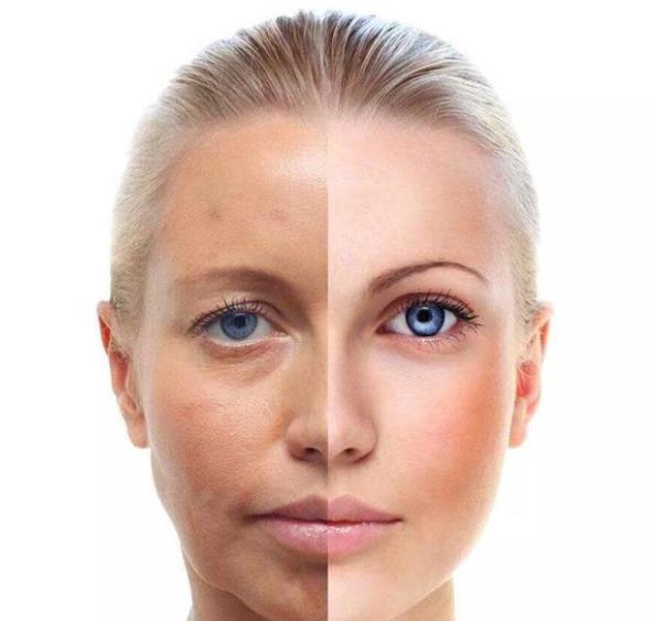 女生的腿為什么都很白，女的為什么比男的白