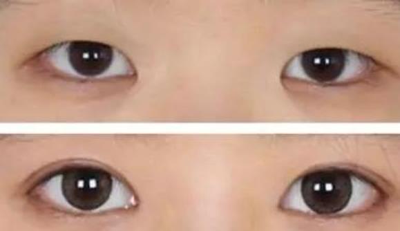 為什么內(nèi)雙最考驗(yàn)顏值，內(nèi)雙眼皮的女生顏值高嗎