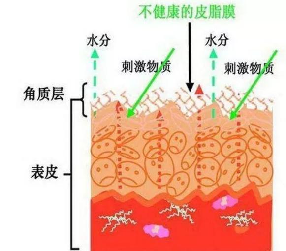 角質(zhì)層薄怎么修復(fù)，角質(zhì)層薄怎么修復(fù)小竅門